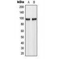 LifeSab™ Hexokinase 3 Rabbit pAb (50 µl)