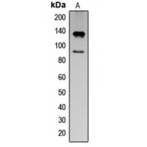 LifeSab™ IFNAR1 (pY466) Rabbit pAb (50 µl)