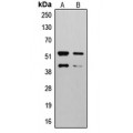 LifeSab™ MMP10 Rabbit pAb (50 µl)