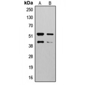 LifeSab™ MMP10 Rabbit pAb (50 µl)