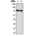 LifeSab™ Delta-NaCH Rabbit pAb (50 µl)