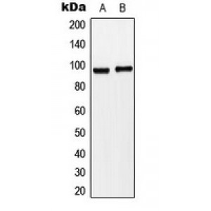 LifeSab™ Matriptase Rabbit pAb (50 µl)