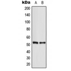 LifeSab™ p53 Rabbit pAb (50 µl)