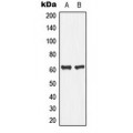 LifeSab™ PLA2G4C Rabbit pAb (50 µl)