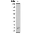 LifeSab™ ABHD14A Rabbit pAb (50 µl)