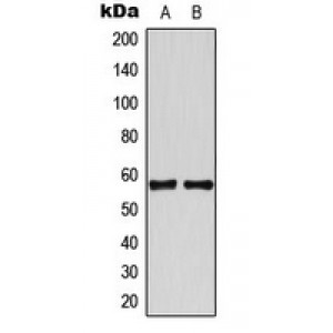 LifeSab™ TBX22 Rabbit pAb (50 µl)