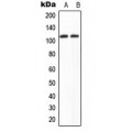 LifeSab™ KIAA1967 Rabbit pAb (50 µl)