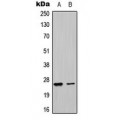 LifeSab™ UBTD1 Rabbit pAb (50 µl)