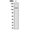 LifeSab™ ACAD10 Rabbit pAb (50 µl)