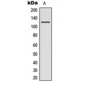 LifeSab™ ACAD10 Rabbit pAb (50 µl)