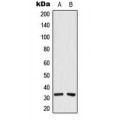 LifeSab™ CEACAM21 Rabbit pAb (50 µl)