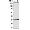 LifeSab™ NKX2-6 Rabbit pAb (50 µl)