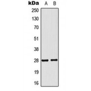 LifeSab™ NKX2-6 Rabbit pAb (50 µl)