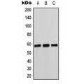 LifeSab™ Cytochrome P450 11B1/2 Rabbit pAb (50 µl)