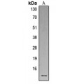 LifeSab™ Defensin alpha 1 Rabbit pAb (50 µl)