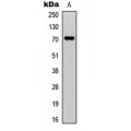 LifeSab™ Factor XI HC Rabbit pAb (50 µl)