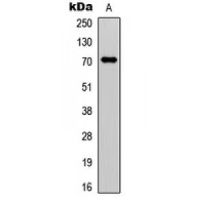 LifeSab™ Factor XI HC Rabbit pAb (50 µl)