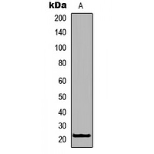 LifeSab™ RhoXF1 Rabbit pAb (50 µl)