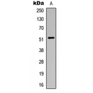 LifeSab™ ALDH3B1 Rabbit pAb (50 µl)