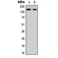 LifeSab™ ANKRD30A Rabbit pAb (50 µl)