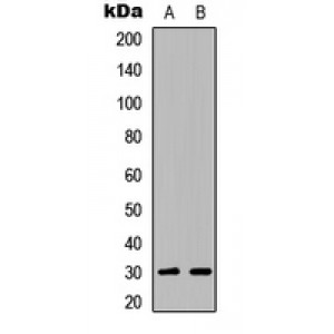 LifeSab™ ATF5 Rabbit pAb (50 µl)