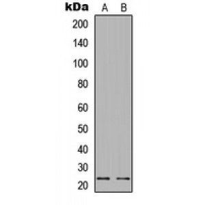 LifeSab™ BAD (pS112) Rabbit pAb (50 µl)