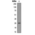 LifeSab™ BCL2 (pS87) Rabbit pAb (50 µl)