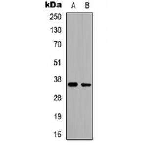 LifeSab™ CD34 Rabbit pAb (50 µl)