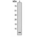 LifeSab™ Cystatin C Rabbit pAb (50 µl)