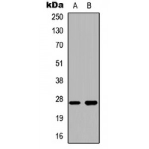 LifeSab™ Cathepsin Z Rabbit pAb (50 µl)