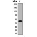 LifeSab™ Cytochrome P450 21A2 Rabbit pAb (50 µl)