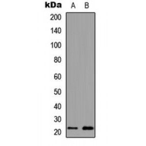 LifeSab™ MYL3 Rabbit pAb (50 µl)