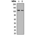 LifeSab™ PRKD2 (pS876) Rabbit pAb (50 µl)