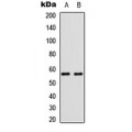 LifeSab™ BMP6 Rabbit pAb (50 µl)