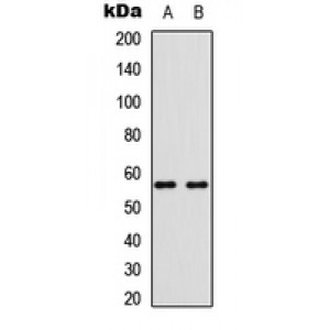 LifeSab™ BMP6 Rabbit pAb (50 µl)