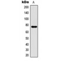 LifeSab™ CPT1B Rabbit pAb (50 µl)