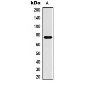 LifeSab™ CPT1B Rabbit pAb (50 µl)