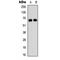 LifeSab™ DDX52 Rabbit pAb (50 µl)