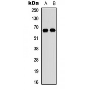 LifeSab™ DDX52 Rabbit pAb (50 µl)