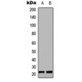 LifeSab™ MRPL35 Rabbit pAb (50 µl)