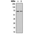 LifeSab™ CAT4 Rabbit pAb (50 µl)