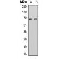 LifeSab™ A-RAF Rabbit pAb (50 µl)