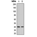 LifeSab™ BDKRB1 Rabbit pAb (50 µl)