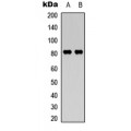 LifeSab™ Calpain 11 Rabbit pAb (50 µl)