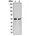 LifeSab™ CD116 Rabbit pAb (50 µl)