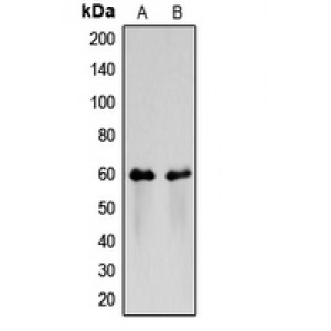 LifeSab™ CD116 Rabbit pAb (50 µl)