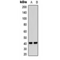 LifeSab™ PAR4 Rabbit pAb (50 µl)