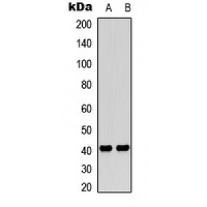 LifeSab™ PAR4 Rabbit pAb (50 µl)