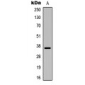 LifeSab™ IGFBP1 Rabbit pAb (50 µl)