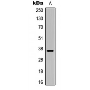 LifeSab™ IGFBP1 Rabbit pAb (50 µl)